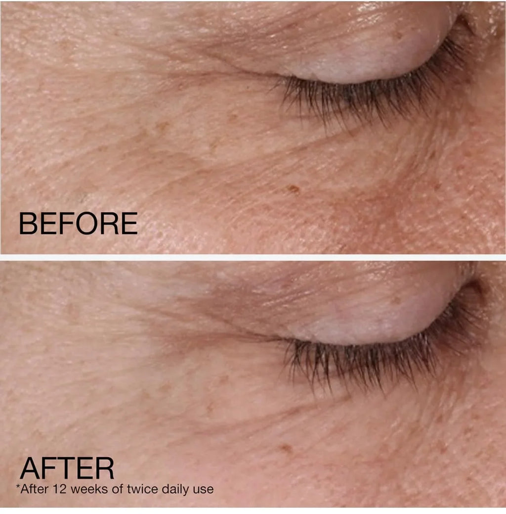 Repair With Pk. Acid Retinol Fragrance 1.7 Anti-Aging Lines, Daily Free, Rapid Moisturizer, & Fight Neutrogena & Wrinkles, Retinol To Fine Dark Wrinkle Oz., Hyaluronic Cream Face Spots, 2 Face