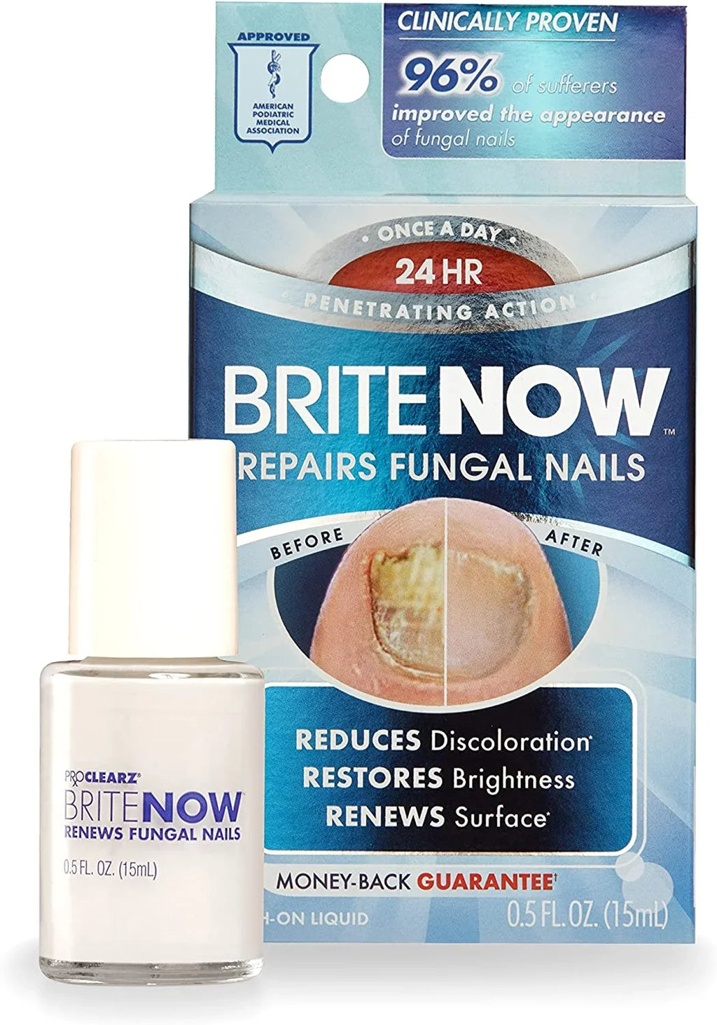 Brite Restores Brightening The Nail Repair, Technology, 0.5 Now Treatment, Nail Discolored Smoothing Appearance Ounce Nails, & ProClearz Peel-Away Of Damaged &